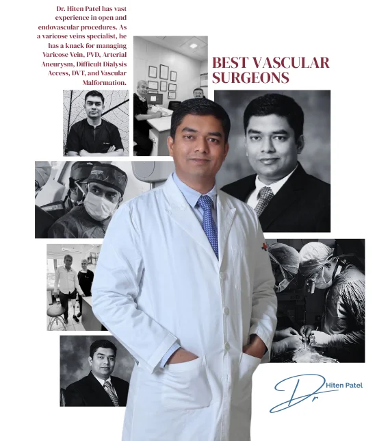 Best Vascular Surgeons